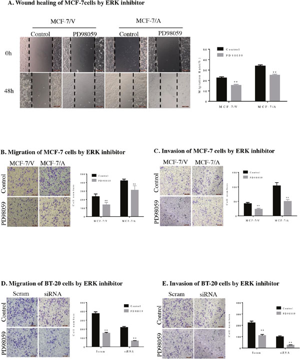 AKR1B10 promotes the migration and invasion of MCF-7 cells by ERK signaling pathway.