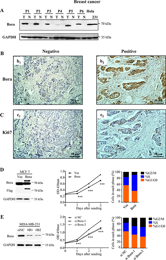 Bora was overexpressed in breast cancer tissues and enhanced cell proliferation.
