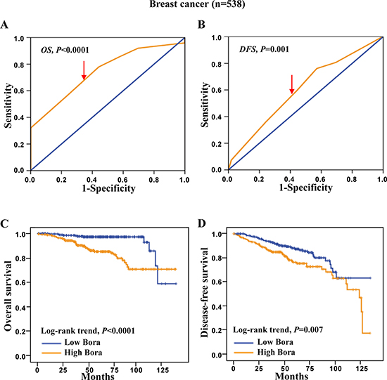 ROC curves and Kaplan-Meier survival analysis in breast cancer.