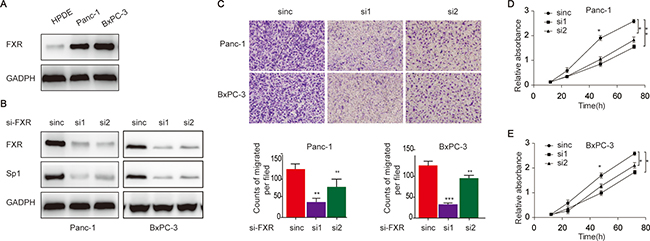 Elevated FXR in pancreatic cancer cells associate with increased proliferation and migration capacities.