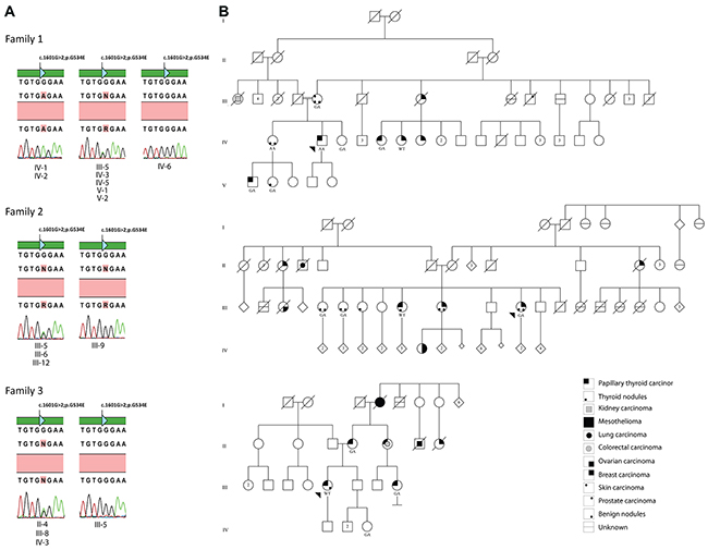 Segregation analysis and HABP2 p.G354 status in Family 1, 2 and 3.