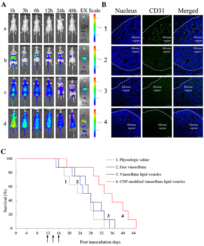 Real-time imaging and overall anticancer efficacy in glioma-bearing mice in vivo.