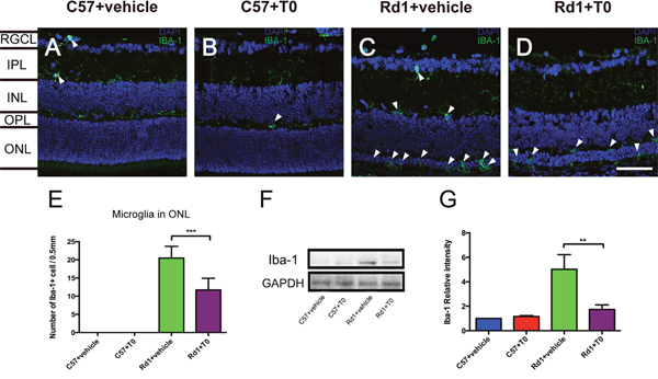 Effect of T0 on Iba-1-positive microglia cells in the retina of C57 mice and rd1 mice at P14.