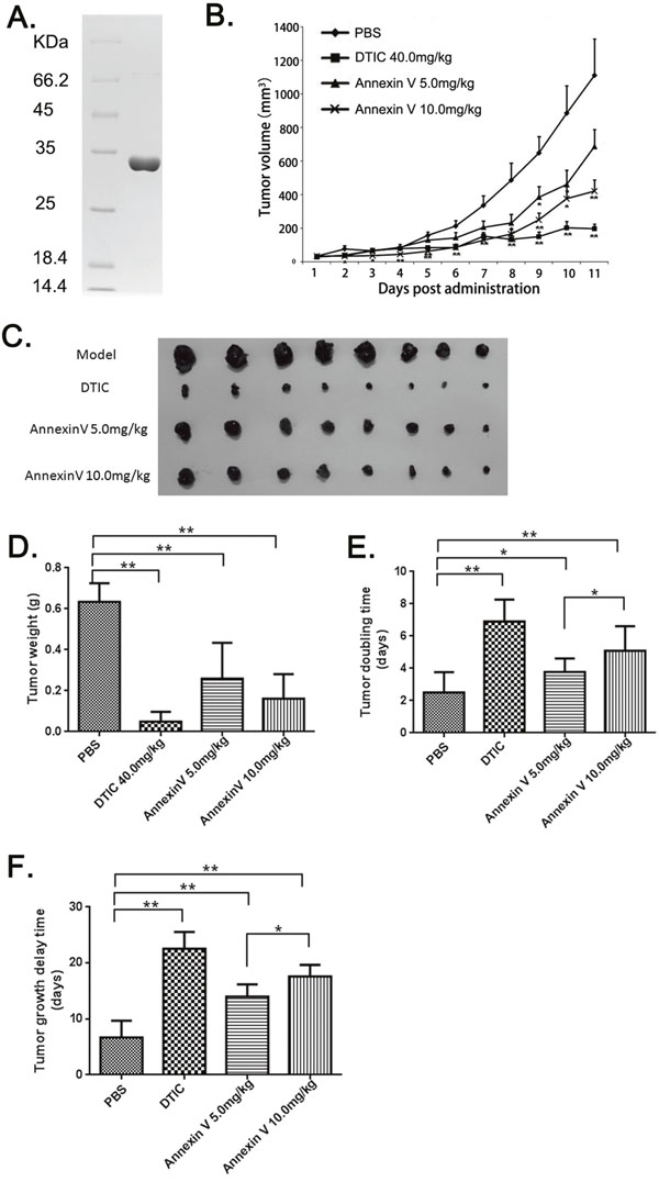 The anti-tumor effects of Annexin V in mice bearing B16F10 melanomas.