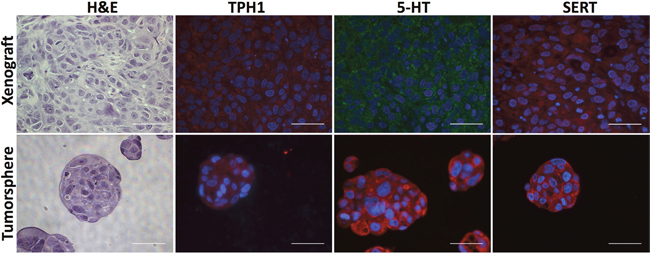 HCC1954 breast tumor xenografts and tumorspheres express TPH1, 5-HT and SERT.