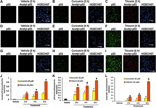 TriCurin is more potent than curcumin in regulating p53 in TC-1 cells.