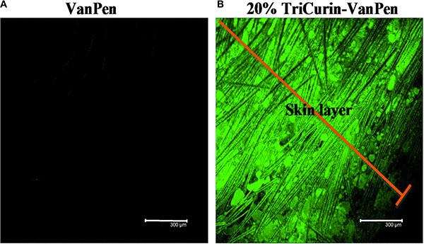 TriCurin-VanPen applied topically allows permeation of curcumin through the skin.