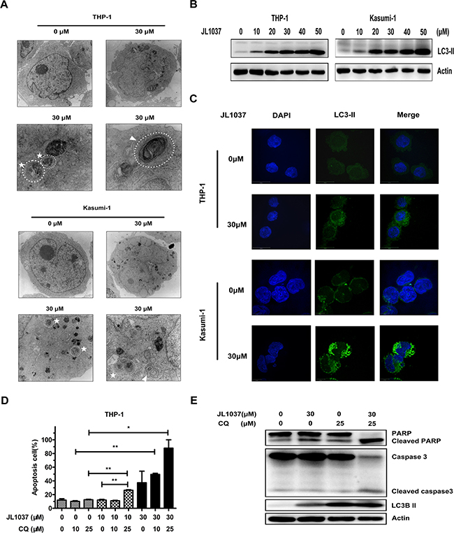 JL1037 induces cell autophagy in THP-1 and Kasumi-1 cells.