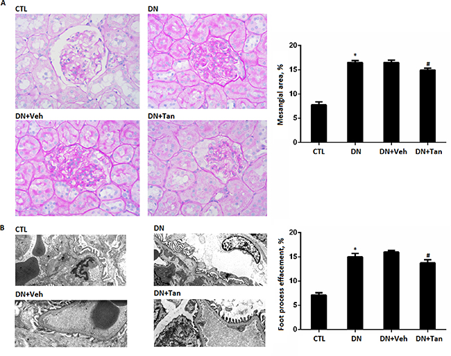 The effect of Tanshinone IIA on morphology change in diabetic rats.