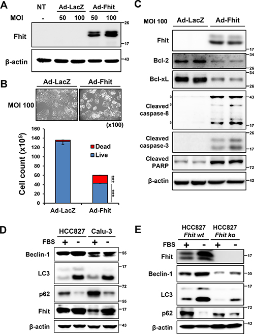 Starvation-induced autophagy and up-regulation of Fhit in NSCLC cells.