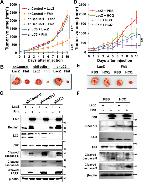 Inhibition of autophagy enhances the antitumor effect of Fhit protein