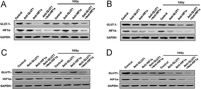 West-blotting analysis showed the protein levels of GLUT-1 and HIF-1&#x03B1; protein.