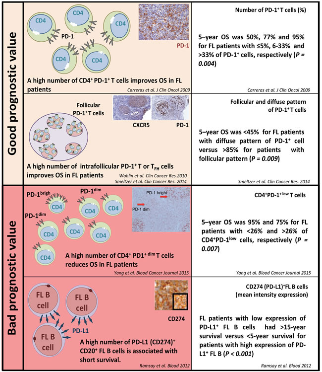 PD-1/PD-L1 expression and their prognostic value in follicular lymphoma.