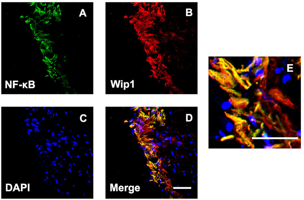 Double labeling immunofluorescent for NF-kB and Wip1 in ERM.
