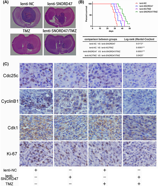 Overexpression of SNORD47 inhibited U87-MG orthotopic glioblastoma model and sensitized the temozolomide treatment in vivo.