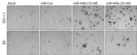 Figure 4 - Senescence.jpg