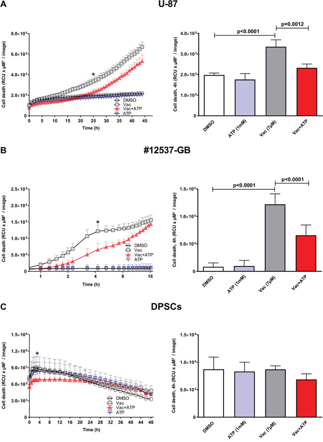 Vac efficiently kills glioma cells in an ATP-sensitive manner, but does not affect DPSCs.