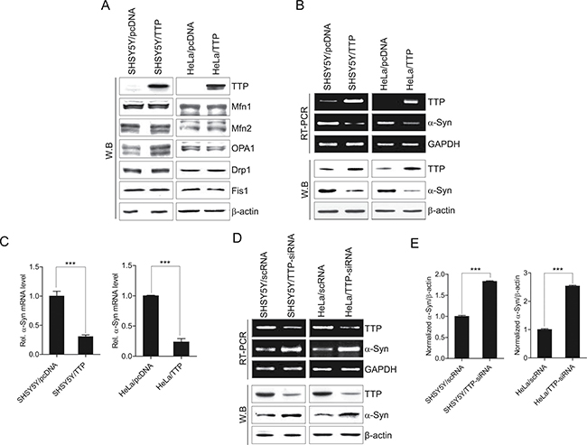 TTP overexpression does not inhibit Mfn1, Mfn2, OPA1, Drp1, and Fis1 expression levels but decreased &#x03B1;-Syn levels.