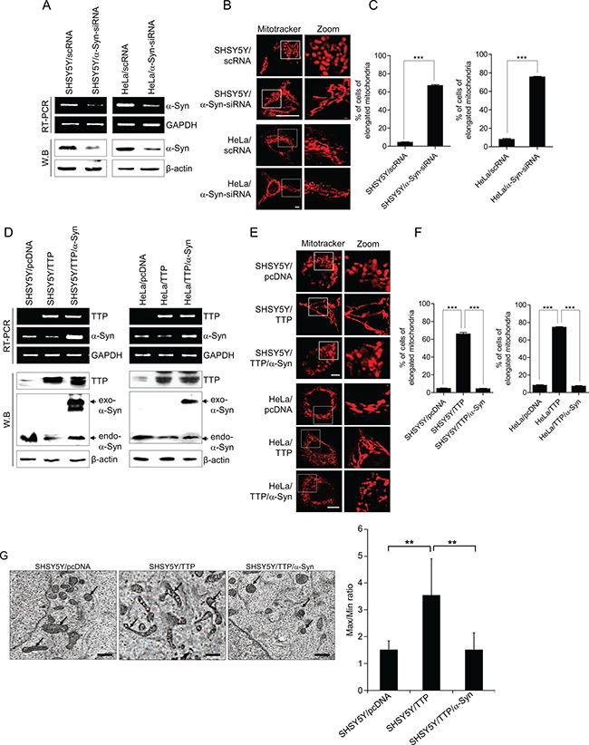 Overexpression of &#x03B1;-Syn inhibits mitochondrial elongation induced by TTP overexpression.