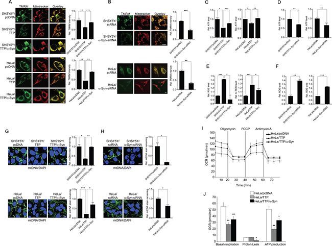 TTP overexpression induces mitochondrial dysfunction.