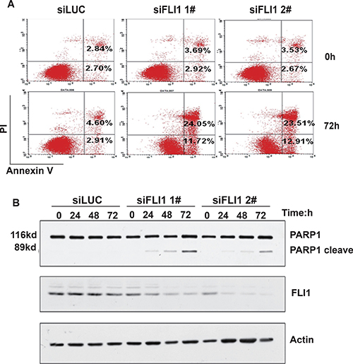 FLI1 knockdown promotes cell apoptosis.