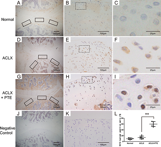 Expression and location of Nrf2 in the knee articular cartilage examined with immunohistochemistry.