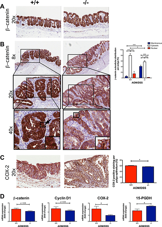 Decreased expression of nuclear &#x03B2;-catenin and COX-2 in AOM/DSS Cysltr1&#x2212;/&#x2212; mice.