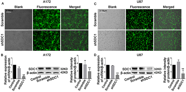 SDC1 knockdown inhibits the expression of PCNA and MMP-9 mRNA and protein.