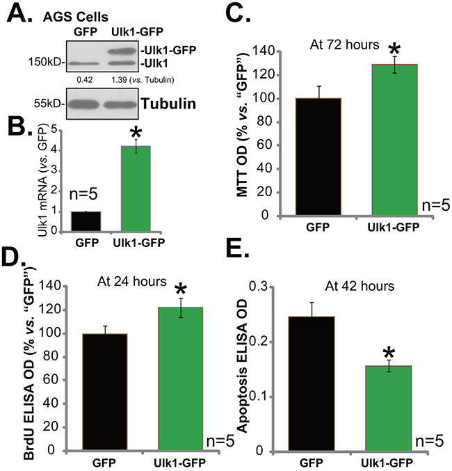 Exogenous over-expression of Ulk1 promotes gastric cancer cell survival.