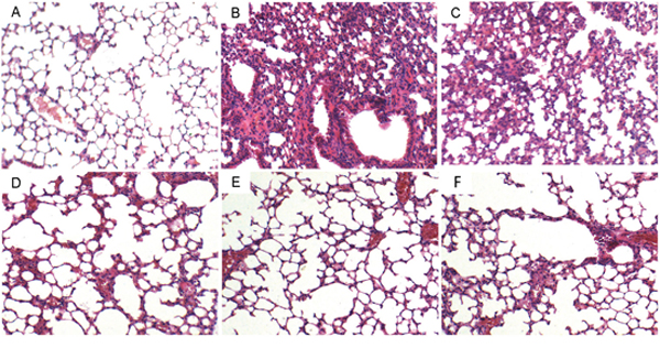 Effects of gastrodin on histopathological changes in lung tissues in LPS-induced ALI mice.