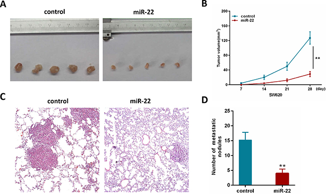 MiR-22 suppresses the growth and metastatic ability of CRC cells in vivo.