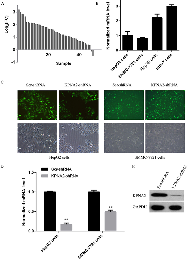 KPNA2 expression status and its knockdown at both the mRNA and the protein levels in human hepatocellular carcinoma cell lines HepG2 and SMMC-7721 using a lentivirus-mediated shRNA strategy.