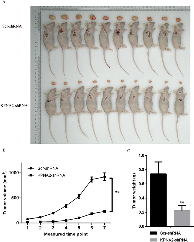 Tumorigenesis was inhibited by KPNA2 knockdown in a xenograft hepatocellular carcinoma model in nude mice.
