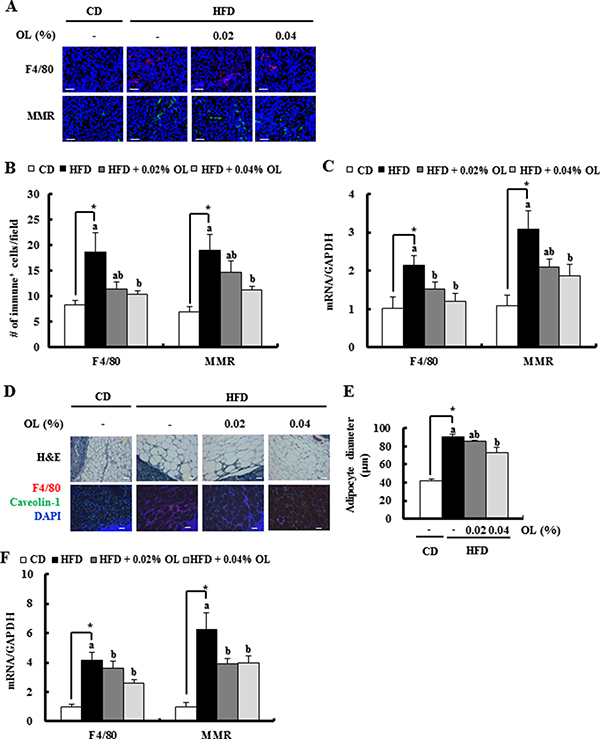 OL suppresses HFD-induced accumulation of M2-macrophages in the tumor tissues and adipose tissues surrounding the LNs.