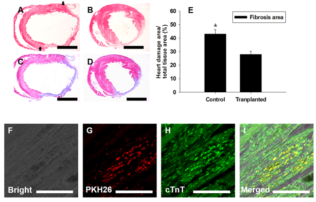 Transplantation of PDGFRA