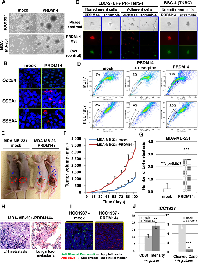 PRDM14 is required for the stemness phenotype of breast cancers.