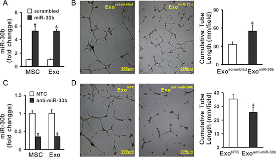 Pro-angiogenic properties of exosomes is associated with the expression of miRs.