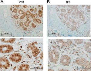 Expression of VRK1 in normal human breast tissue.