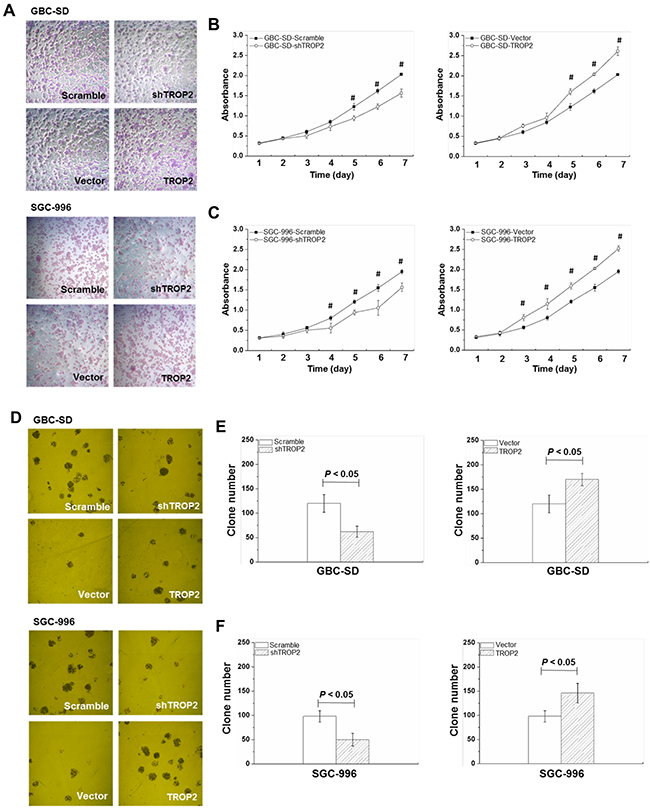 Effects of TROP2 on proliferation and clone formation of GBC-SD and SGC-996 cells.