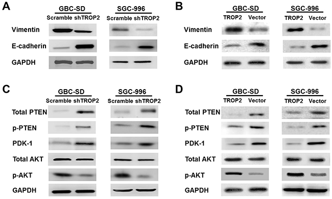 Effects of TROP2 on EMT and PI3K/AKT pathway in GBC-SD and SGC-996 cells in vitro.