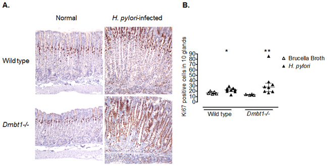 Enhanced proliferation of gastric epithelial cells in Dmbt1-/- mice following H. pylori infection.