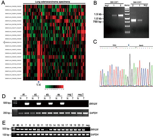 Identification of a novel BMX skipping isoform in human lung adenocarcinomas.