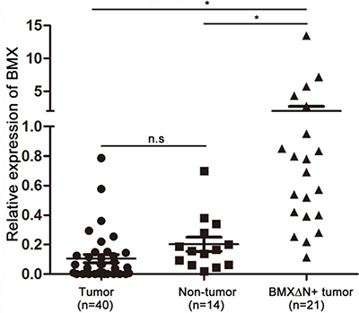 Expression of the BMX gene in lung adenocarcinomas.