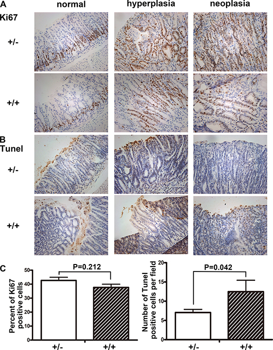 Immunohistochemistry