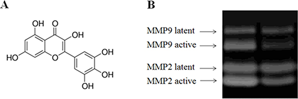 Increased expression level of active MMPs in fibroblasts treated by high glucose (30 mM).