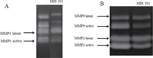 Effect of MDI 301 on the formation of active MMPs by MMP zymography assays.