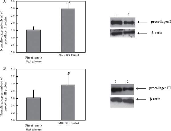 Effects of MDI 301 on procollagen I and III.