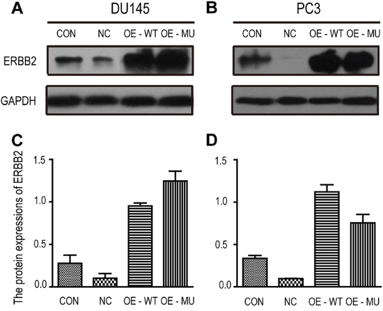 Western blot analysis of ERBB2 expression in DU145 and PC3 cells from the wound healing assay.