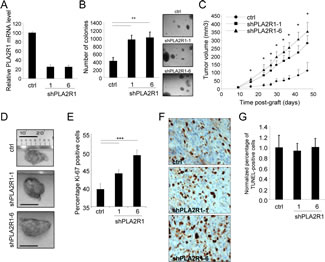 PLA2R1 knockdown favors RCC-derived cell tumorigenicity.