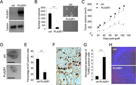 PLA2R1 expression inhibits transformation and decreases tumor growth.